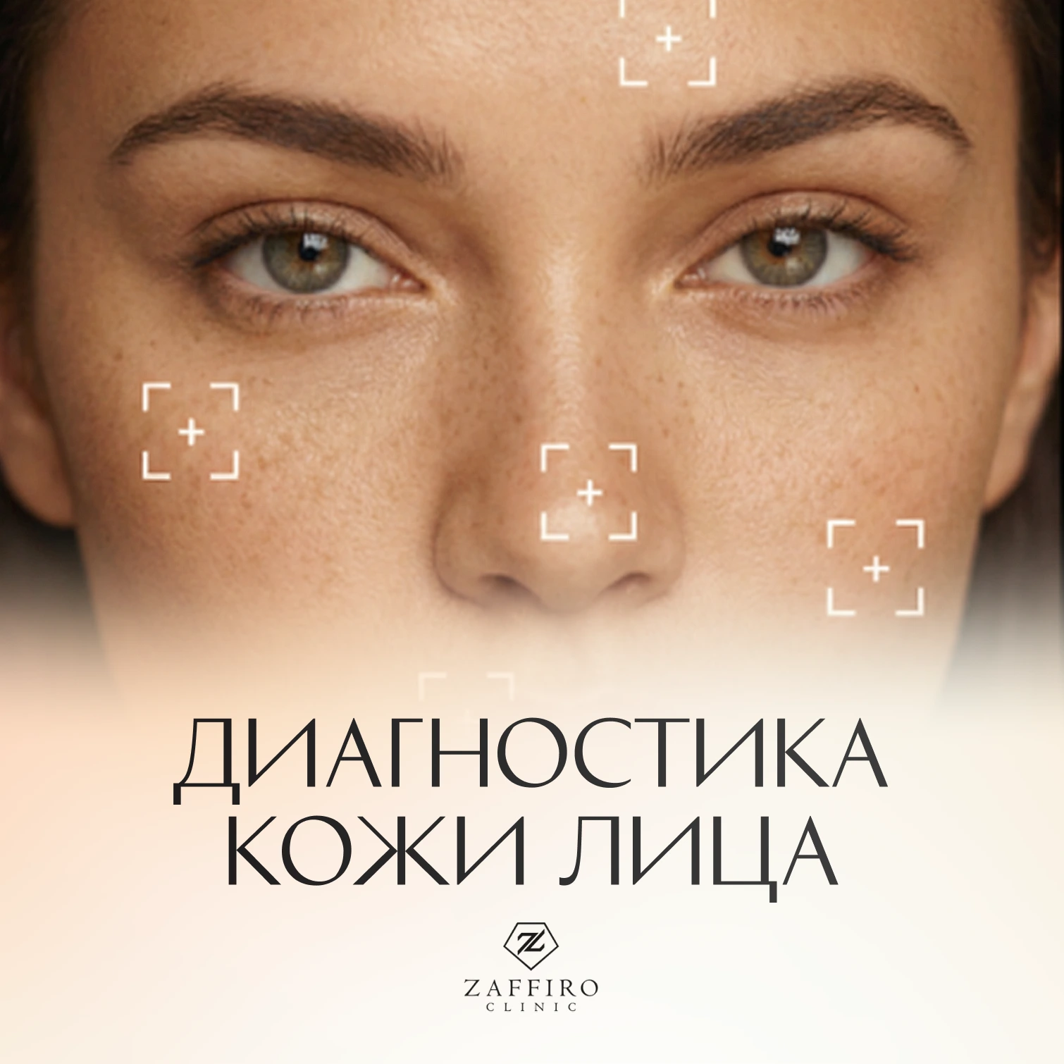 Zaffiro Clinic: Диагностика кожи