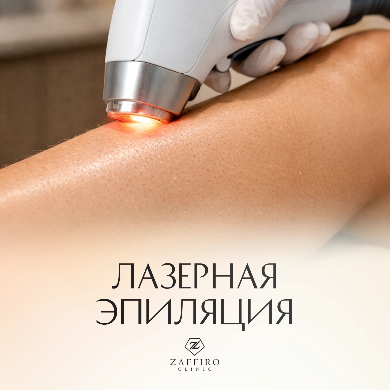 Zaffiro Clinic: Лазерная эпиляция